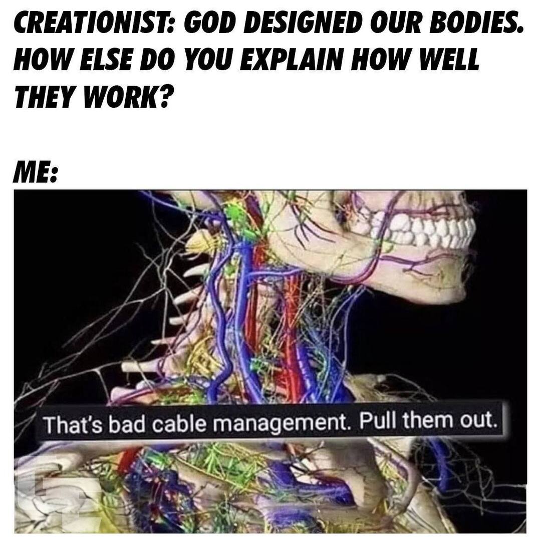 GodlessEngineer's tweet photo. Creationists like Ray Comfort (of Living Waters ) will try to sell you on the idea that the body is expertly designed while you both look at shit like this.

#creationism #intelligentdesign #evolution #atheist #atheism #atheistcommunity #godlessengineer #sciencevsreligion #badd… https://t.co/rS4tsaQ4gh