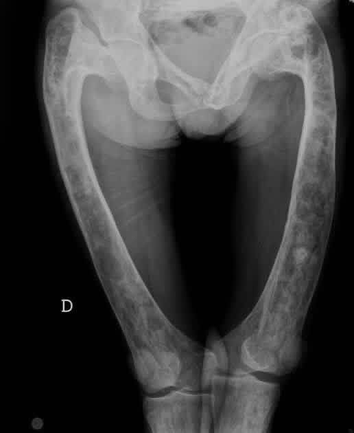 hemo_shk's tweet image. #Xray

Diagnosis?!

#MEDHM #MedX @IhabFathiSulima