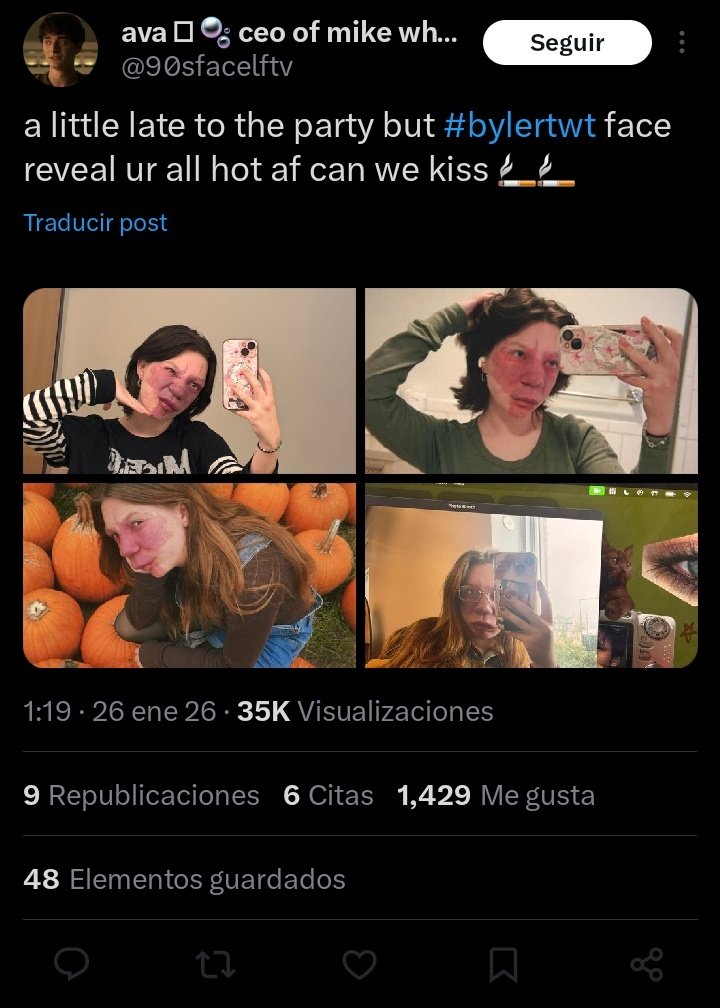 ur genuinely retarded for retweeting this <a href="/explaninglilnax/">Nightskin | Columbina and Aemeath No.1 defender</a>