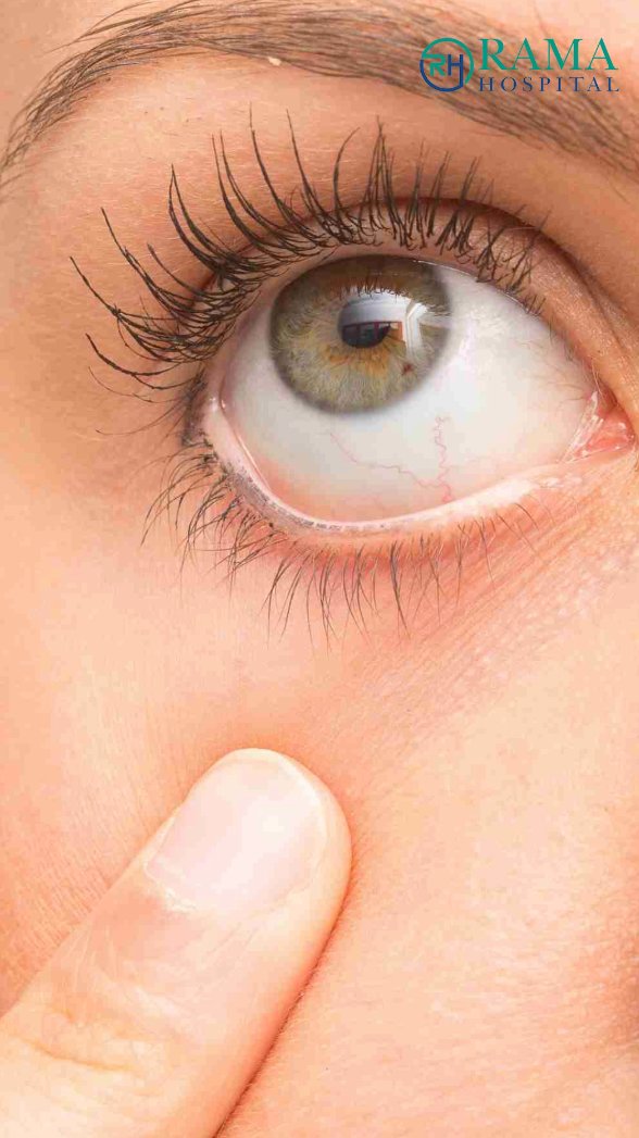 ✅Dry Eyes Treatment Hindi 
Dr. Priyanka Dubey discusses the causes of dry eyes in winter,  effective treatment options, and simple winter eye-care tips to maintain eye comfort and vision.
youtube.com/shorts/f5_xspZ…