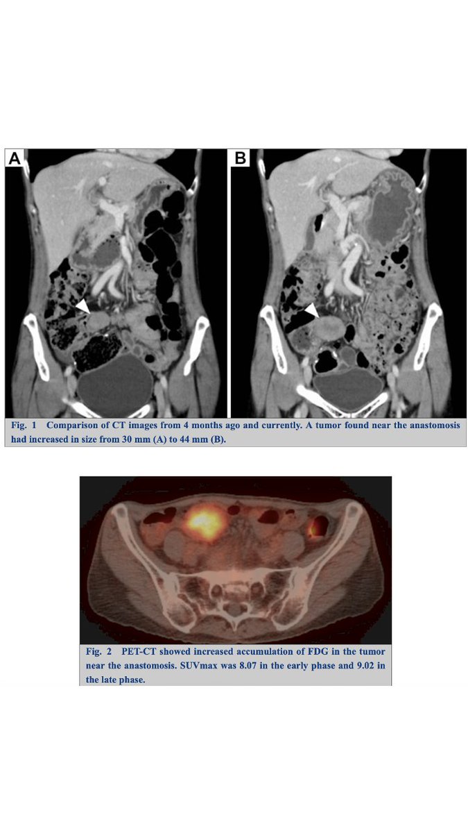 日本消化器外科学会 tweet media