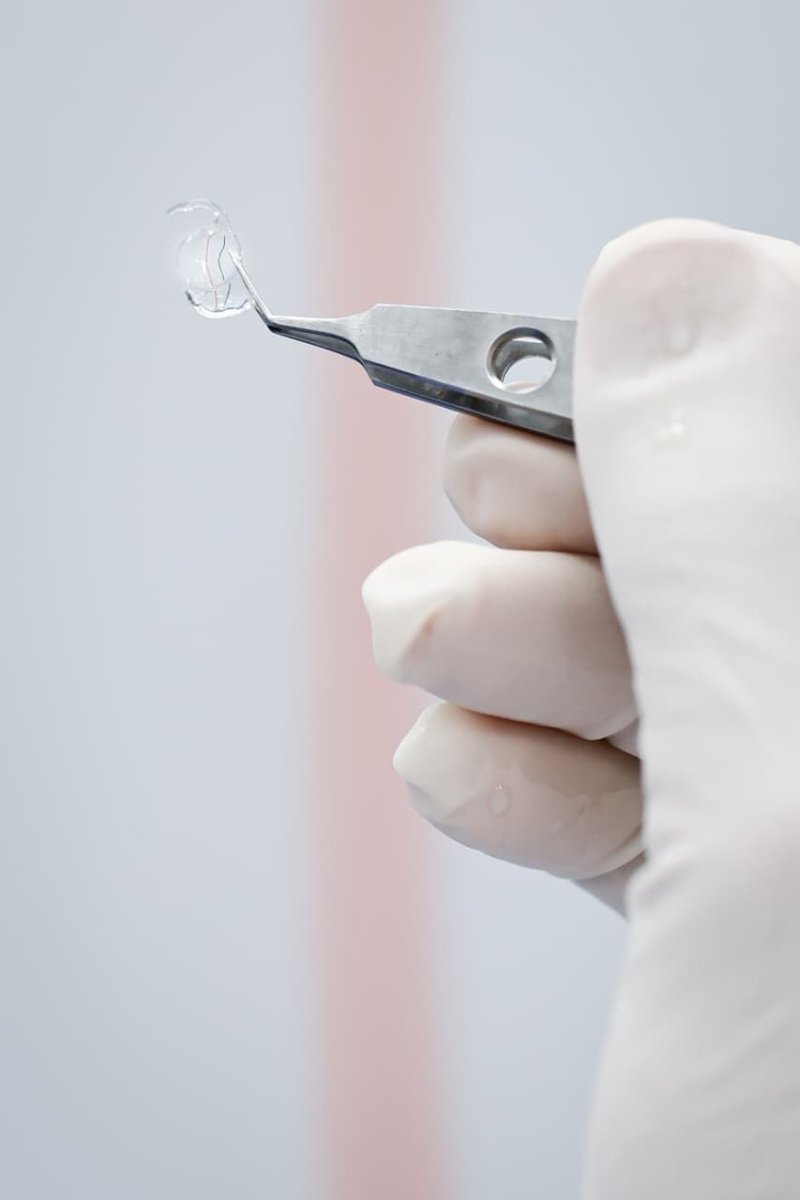 Después de una exitosa jornada quirúrgica en el Hospital Regional de Alta Especialidad del <a href="/ISSSTE_mx/">ISSSTE</a> en Acapulco, Guerrero, hoy 82 derechohabientes diagnosticados con cataratas recuperaron la vista. Es la primera de varias jornadas que se llevarán a cabo.