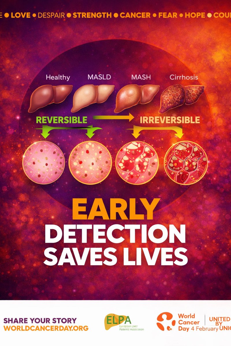 EuropeLiver's tweet image. 💜 #WorldCancerDay | #UnitedByUnique
🧡 #Early detection saves lives — especially for #LiverCancer.
📢 With #MASLD affecting around 25% of Europe’s population, early detection and prevention are not optional — they are lifesaving

Many people still believe liver cancer “appears…