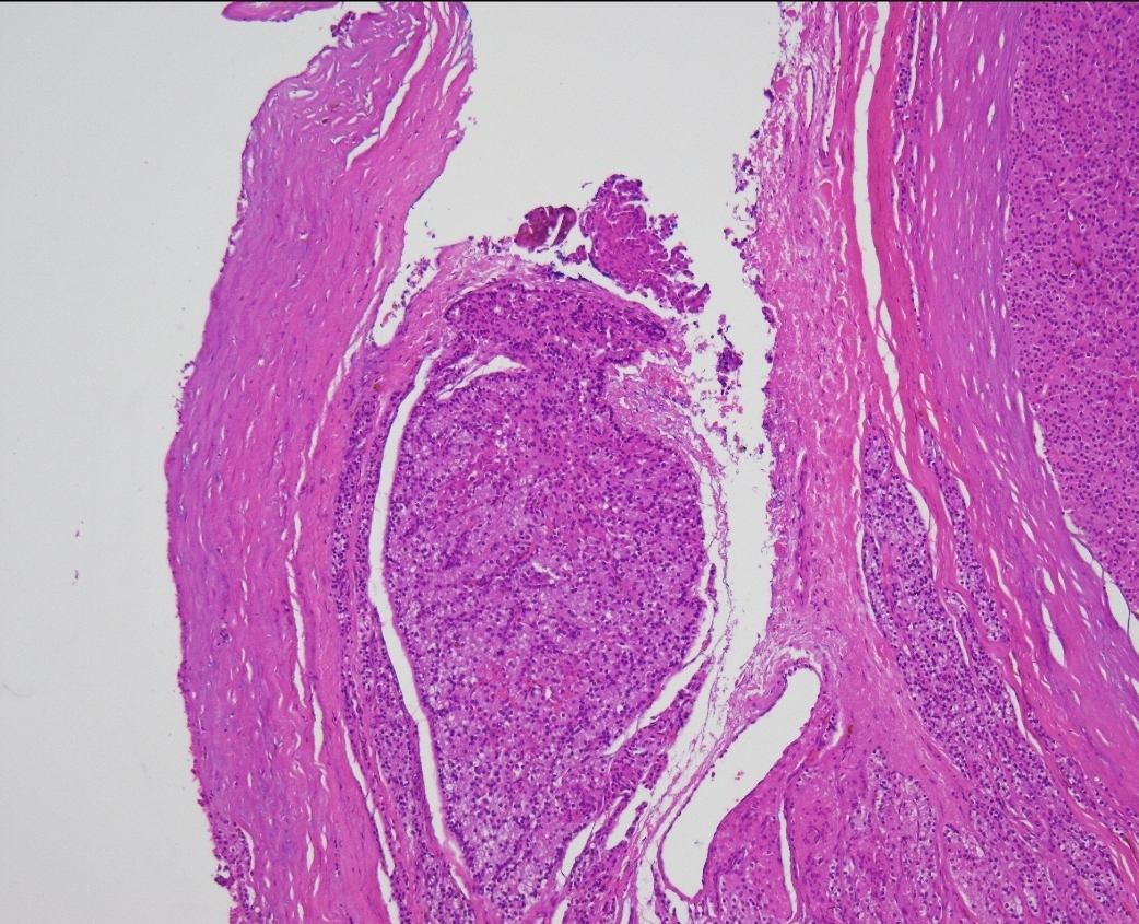 Angela Chou tweet media