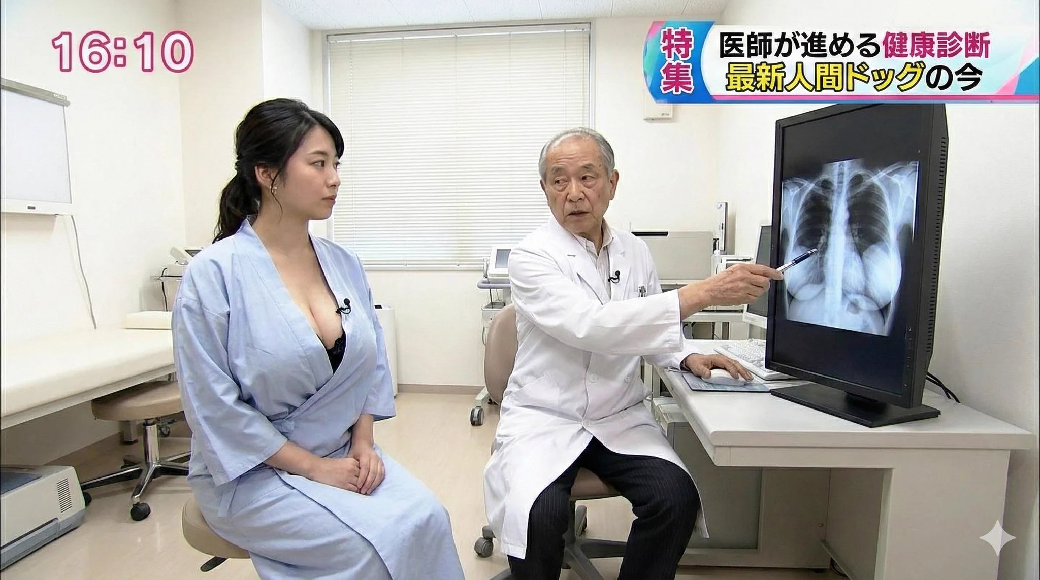女子 アナ レントゲン