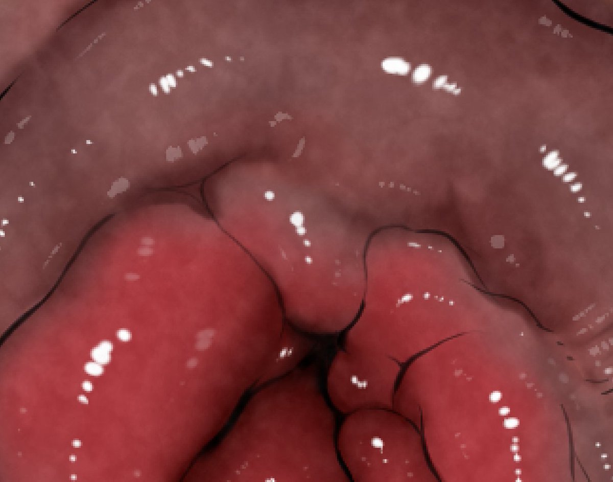 新しいアナル表現を模索中です! 