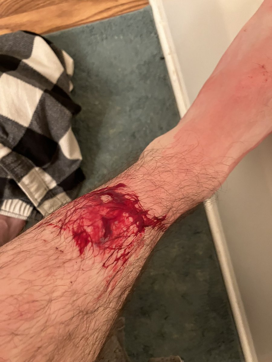 Moba Blueba (OPERATION EVEREST RELEASES APRIL 10) tweet media