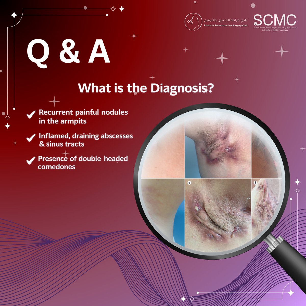 Plastic & Reconstructive Surgery Club tweet media