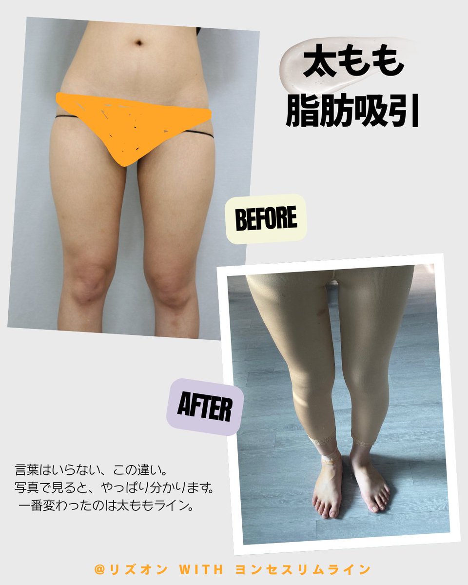 ヨンセスリムライン医院 tweet media