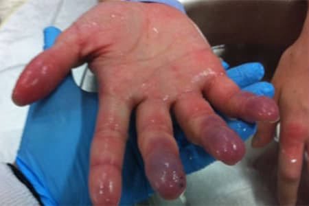 Ahmed in gaza 🇵🇸🍉 tweet media