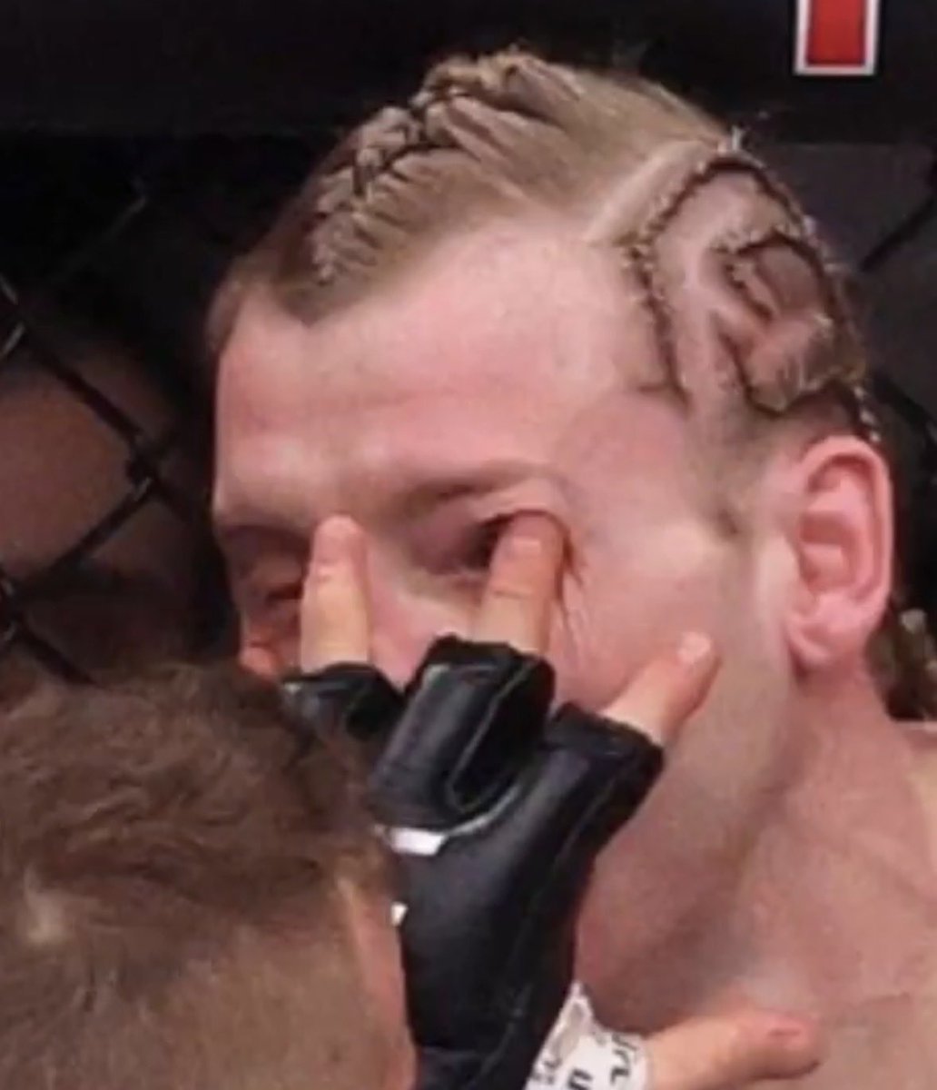 sammy_neff's tweet photo. @HappyPunch Yall still think Gaethje played fair????? https://t.co/lvUR1JCswS
