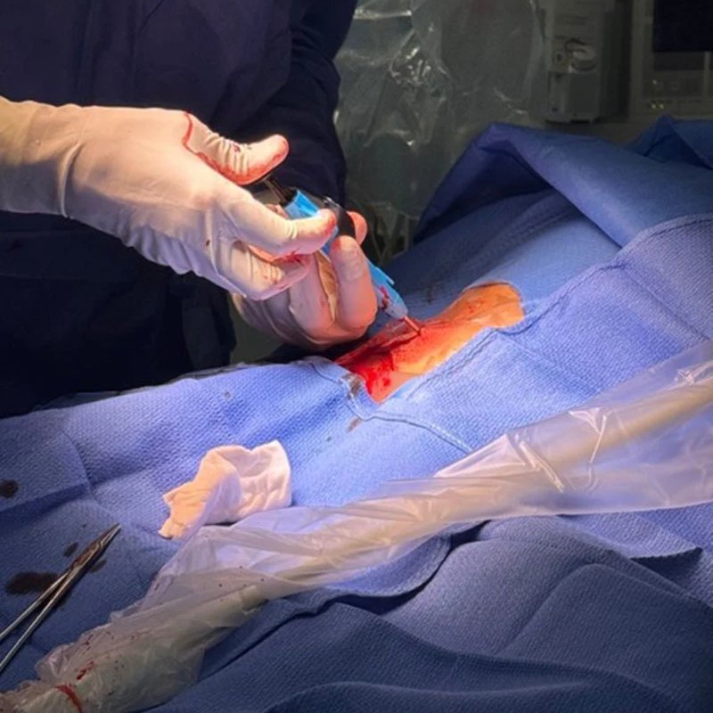 PCRonline 🫀 tweet media