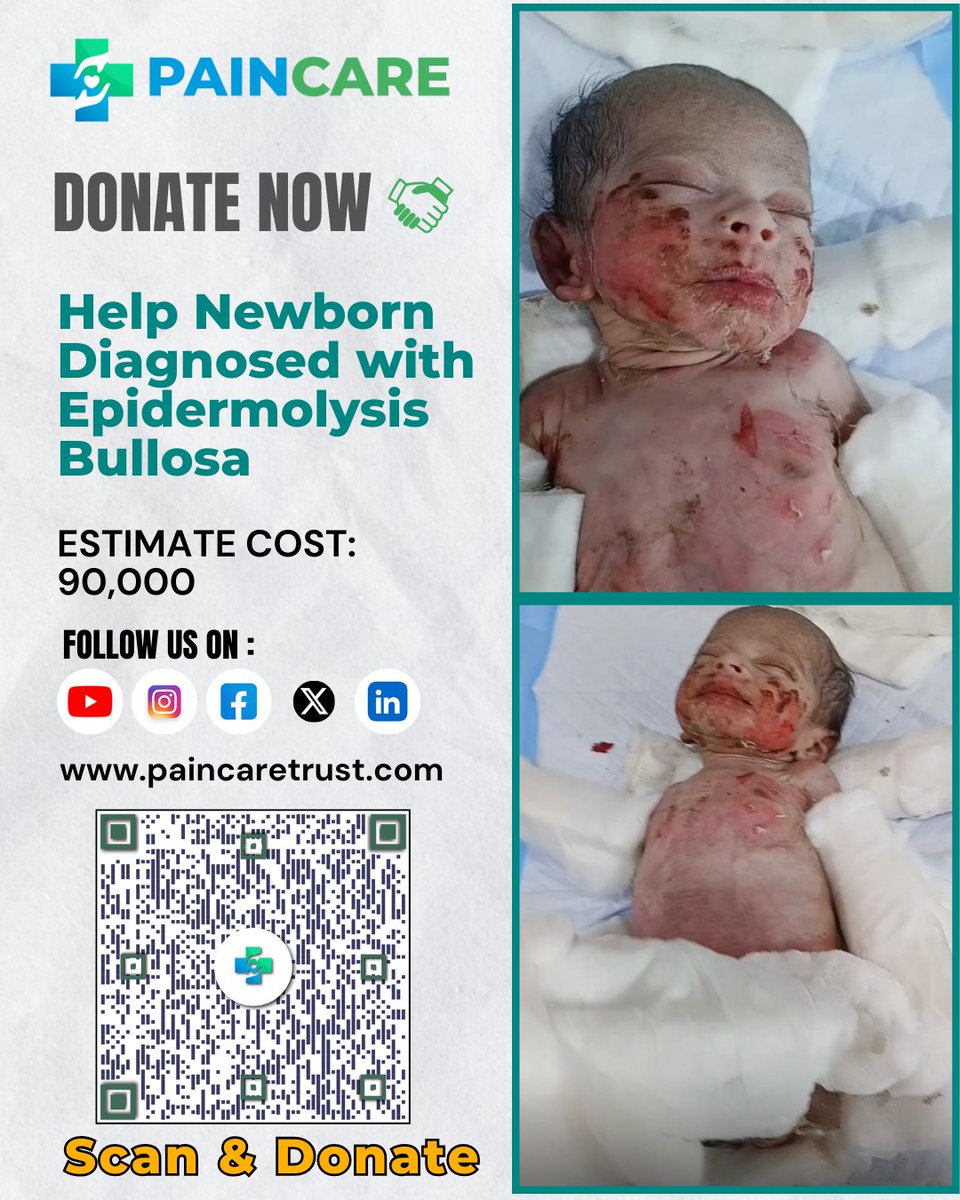 𝐃𝐎𝐍𝐀𝐓𝐄 𝐍𝐎𝐖
paincaretrust.com/cause/5304

Help Newborn Diagnosed with Epidermolysis Bullosa
Estiamte Cost-  ₹90,000 

website:paincaretrust.com

Contact us: 9011394332/9699706836

#MedicalEmergency #newborn #Donate  #Urgent  #support #mumbra
#help #share #contribute