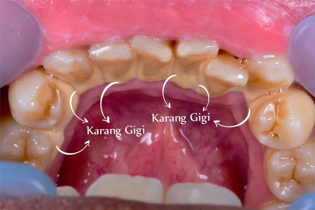 NO DM - KIRIM FESS CEK HIGHLIGHTS tweet media