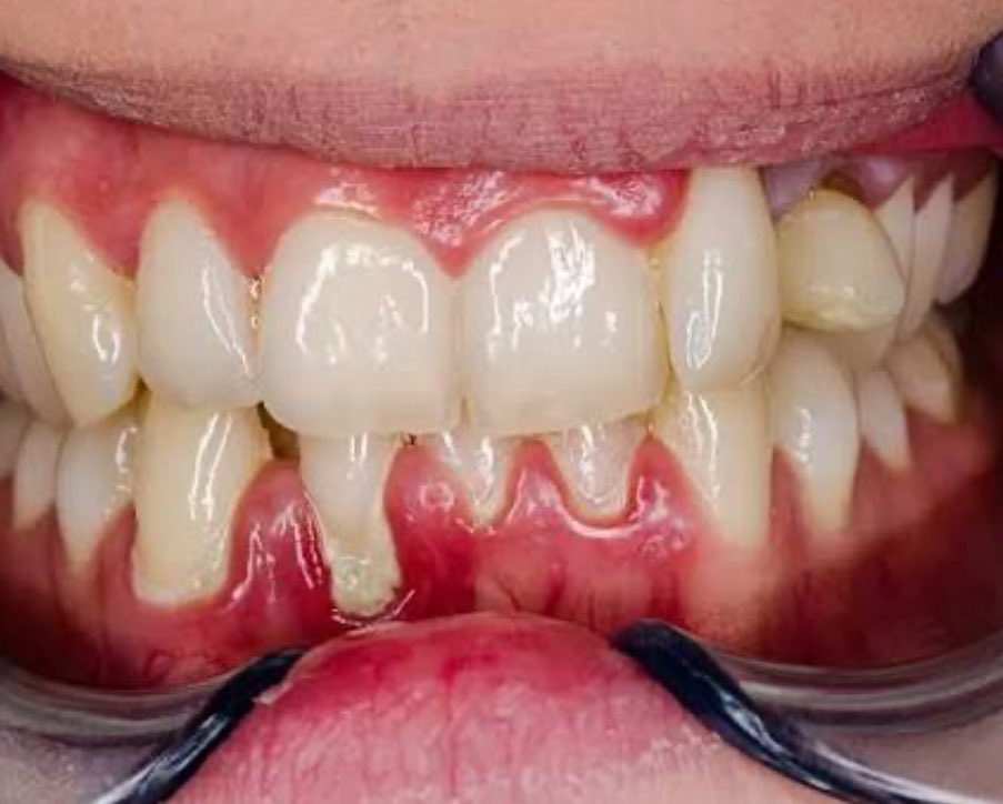 NO DM - KIRIM FESS CEK HIGHLIGHTS tweet media