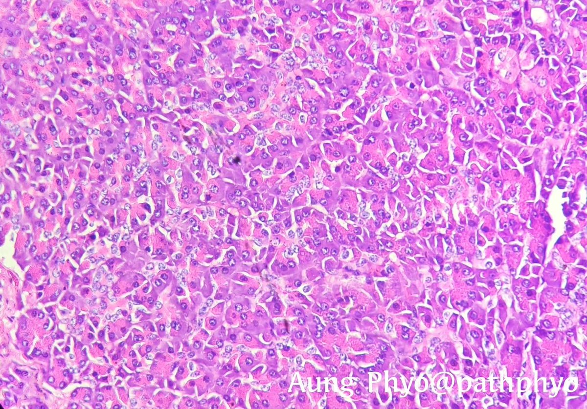 aung phyo tweet media