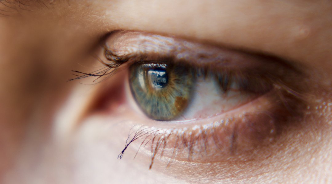 Existeixen diversos procediments per canviar el color de l’iris, però cap està exempt de riscos. ⚠️

S’han descrit complicacions com inflamació ocular, augment de la pressió intraocular, cataractes o danys corneals greus👁️ 

➕ Més informació a #PortalCLÍNIC 👉