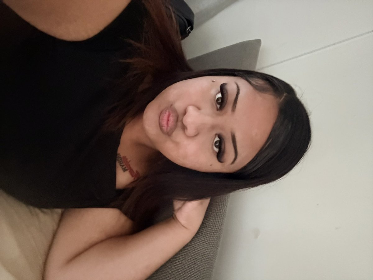 just got my face dermal done lol