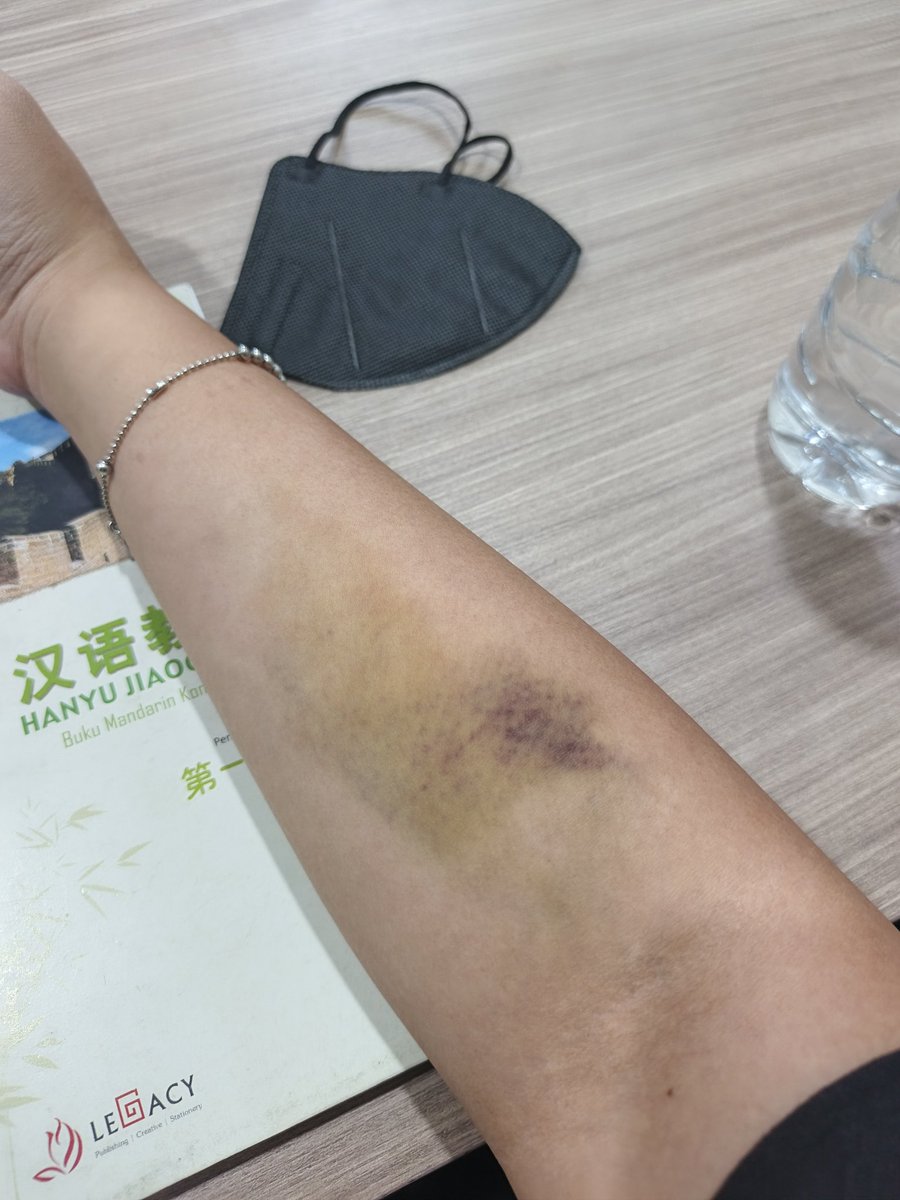 bleuseed's tweet image. Langsung trauma sama kang urut