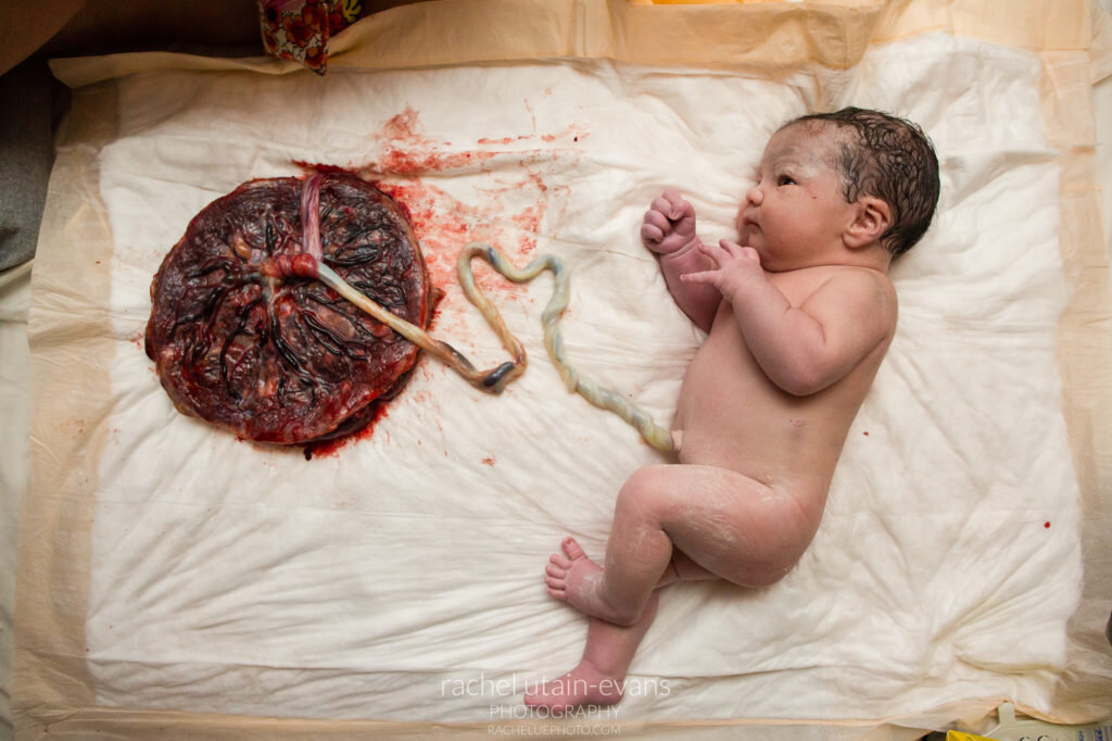 drabdulhameed07's tweet photo. Which of the following drugs do not cross the placenta?

A. Dilantin
B. Diazepam
C. Acinocoumarin
D. Heparin https://t.co/1z741Yph3q