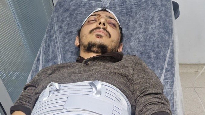 NewsBeru's tweet photo. 📌Diyar Koç’un Sağlık Durumu Ciddiyetini Koruyor 

Nisêbîn’de askerler tarafından darp edilen ve sonrasında tutuklanan Diyar Koç’un sağlık durumu ciddiyetini korurken, avukat görüşüne izin verilmediği belirtildi.

https://t.co/fUu3IniHLr https://t.co/Ws99aoyhJk