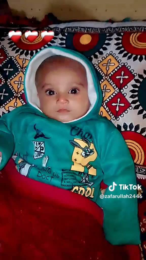 شڪارپور ،
رستم ٿاڻي جي حد ڳوٺ سعدو جتوئي ۾ هڪ سال جو رياست ولد صداقت علي ء وقاص ولد وقار علي ڊونگائي جتوئي ارڙيء وگهي فوت ٿي ويا ،
ڳوٺ ۾ ڪيترائي ٻارڙا ارڙيء ۾ ورتل صحت کاتي نوٽيس نه ورتو
#سنڌ_ڪيئن_اڳتي_وڌندي
<a href="/PPP_Org/">Pakistan Peoples Party - PPP</a> <a href="/MediaCellPPP/">PPP</a>