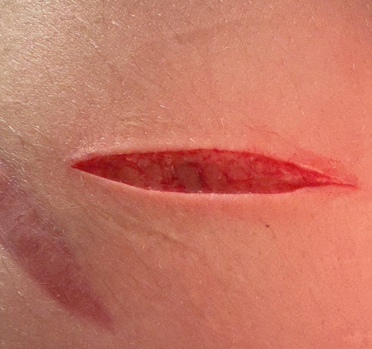 blu3_starburst's tweet photo. Sesh with the awesomest oomfie @Blot_Alien_xoxo !! Last pic is kinda scar check as well!! Also I got a vein when I did this so I couldn’t go deeper 💔💔

#shtwt #shedtwtᅠ #cutspo #oneswipe #slittwt #988twt #shspo #beanspo https://t.co/qFCJER1QGo