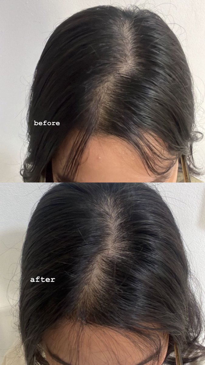 tinkerabhel's tweet photo. hair is hairing💋

soalnya sebagai org ponian nih rambut cepet banget lepek JUJUUURRRRRRR😕 https://t.co/ssUzabqVmh