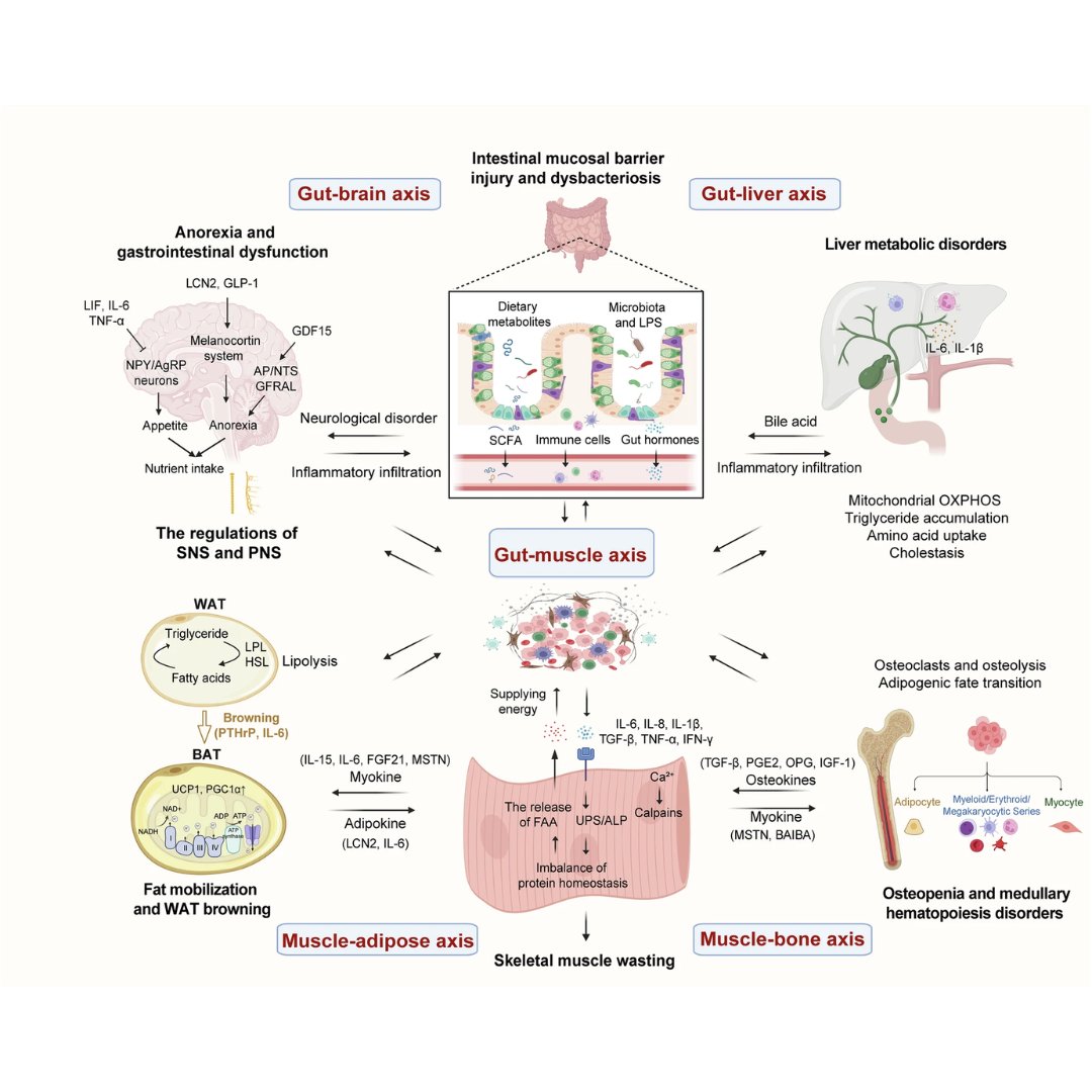 sigtrans_sttt's tweet photo. This #STTT review synthesizes the molecular mechanisms of #CancerCachexia, highlighting systemic #MetabolicRemodeling and multi-organ crosstalk as keys to developing novel therapeutic strategies for clinical #Oncology.

#OpenAccess: https://t.co/Rh0Wv5B8iR https://t.co/8bkCwvGScx