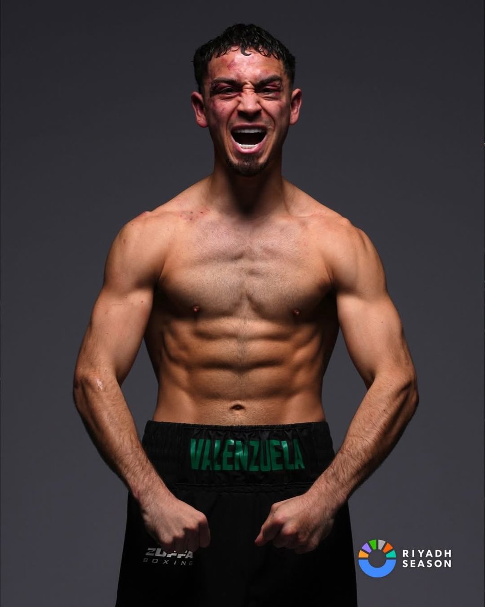 Jose el Rayo Valenzuela tweet media