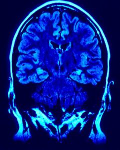BCMFromtheLabs's tweet photo. It takes two: #genes ATP13A2 and GBA1 interact to drive #neurodegeneration https://t.co/g0UL33oOk0 Mingxue Gu, Jinghan Zhao, Mingxi Deng, @LabShulman, Hugo Bellen et al @bcmhouston @TexasChildrens #Parkinsons @MolNeuro @bcmgenetics #BCMPostdoc https://t.co/wlHGsvX9sc