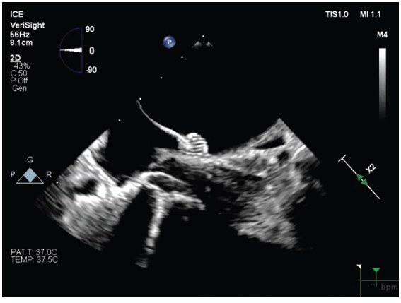 Cath Lab Digest tweet media
