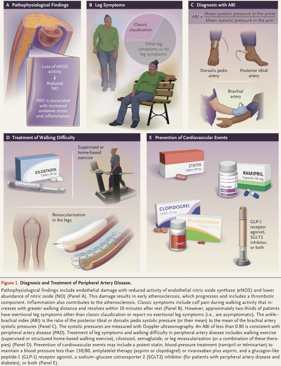 AmbrizMau's tweet image. Diagnóstico y tratamiento de la enfermedad arterial periférica:

N Engl J Med 2026;394:486-96.