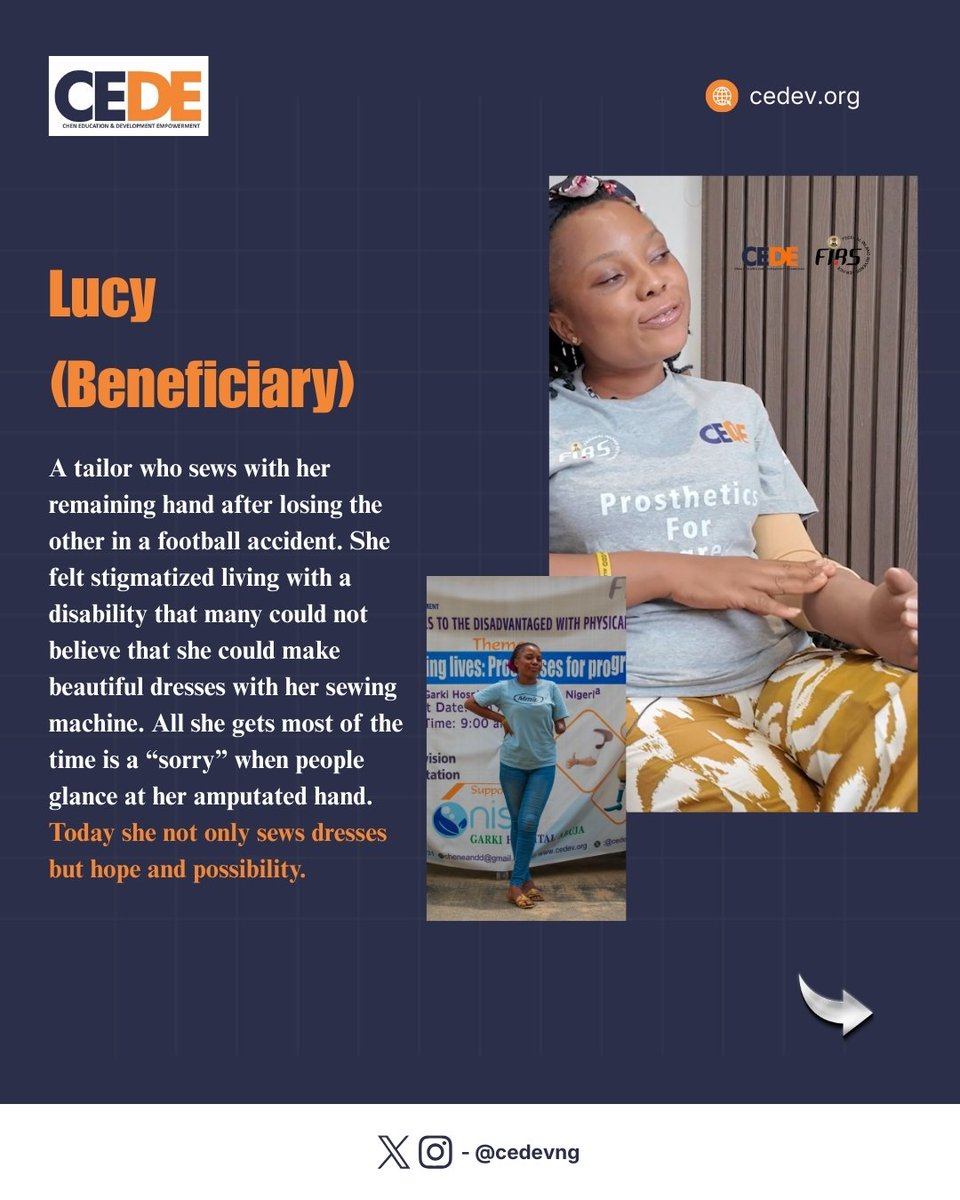 cedevng's tweet photo. For many of our beneficiaries, losing an upper or lower meant losing  mobility, independence, confidence, and sometimes even a sense of belonging. What used to be simple became difficult. What used to be fair suddenly felt unforgiving. #CEDE #CEDEV #ChenEducationAndDevelolment https://t.co/B1lQnQTBJD