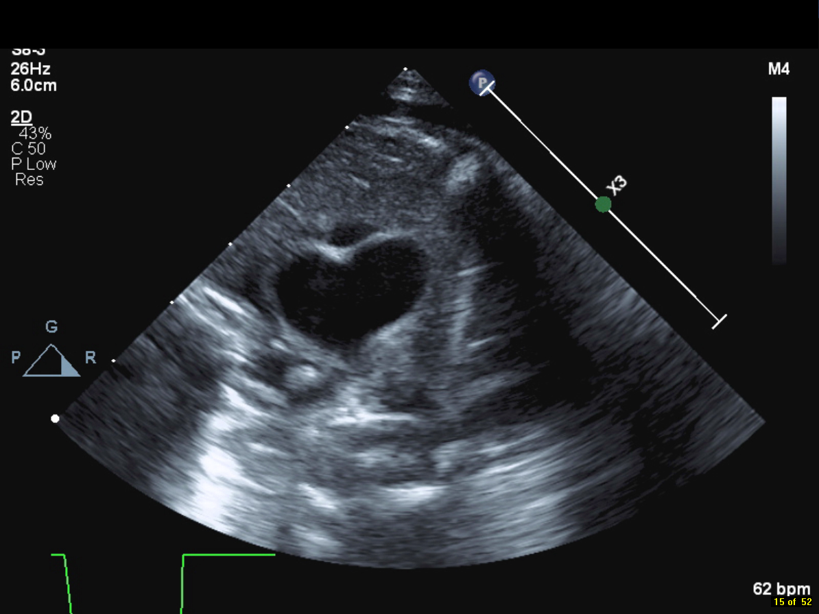 American Society of Echocardiography tweet media
