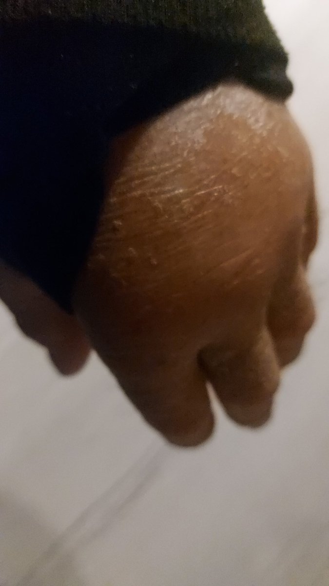 Und ihr so 🥳🫡🫵💪