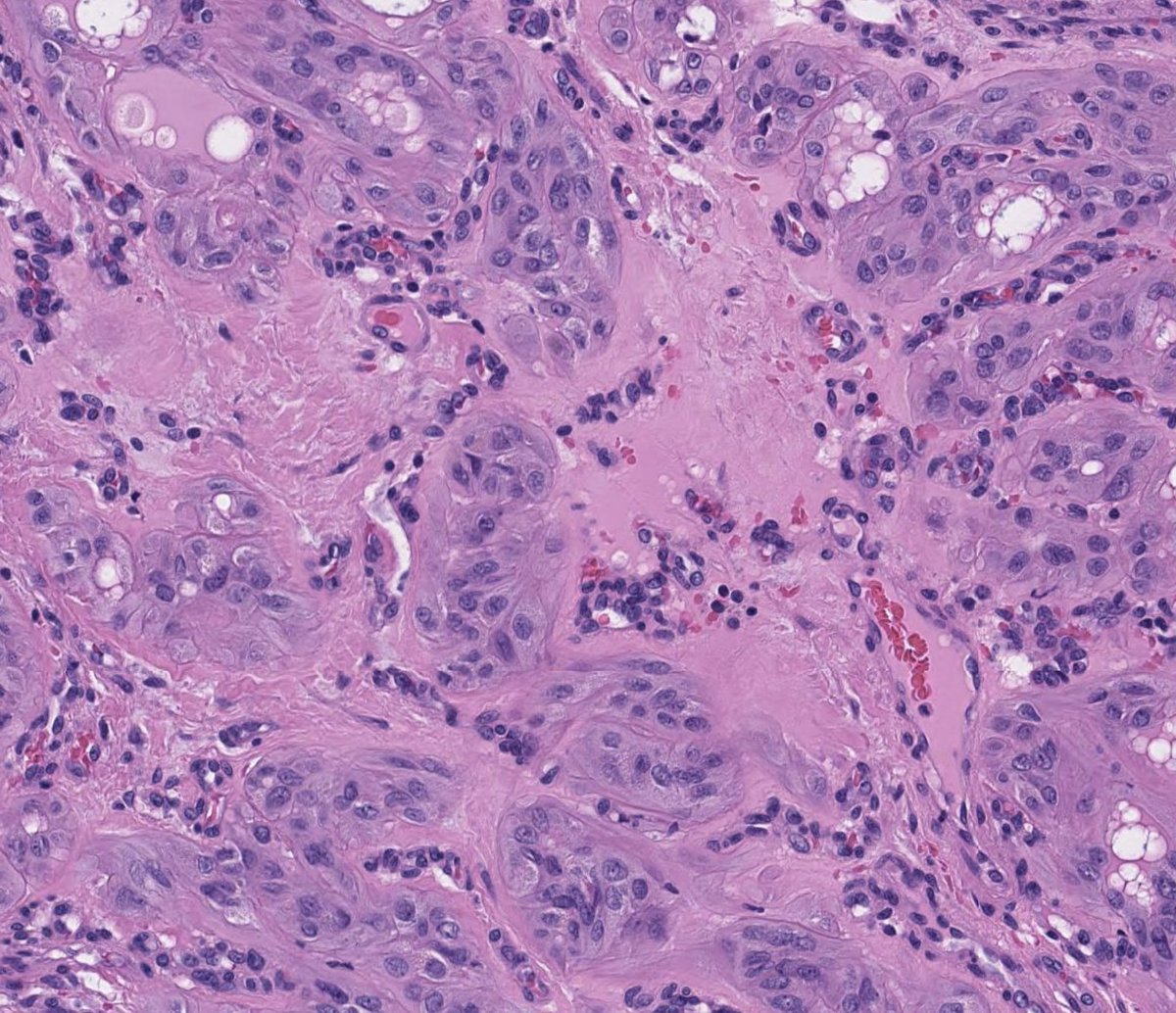 Toby Schmitt, MD tweet media