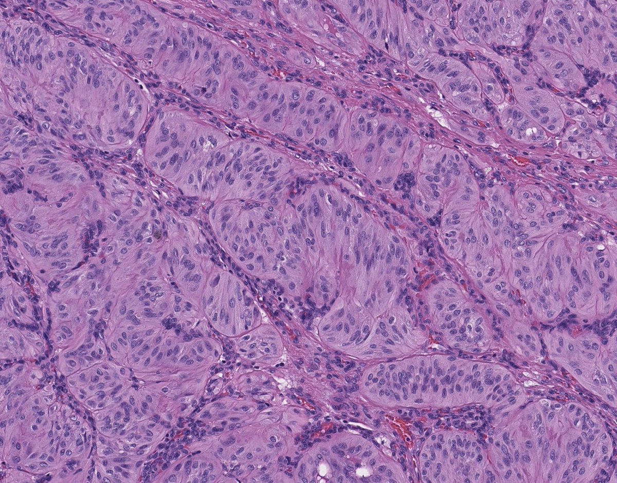 Toby Schmitt, MD tweet media