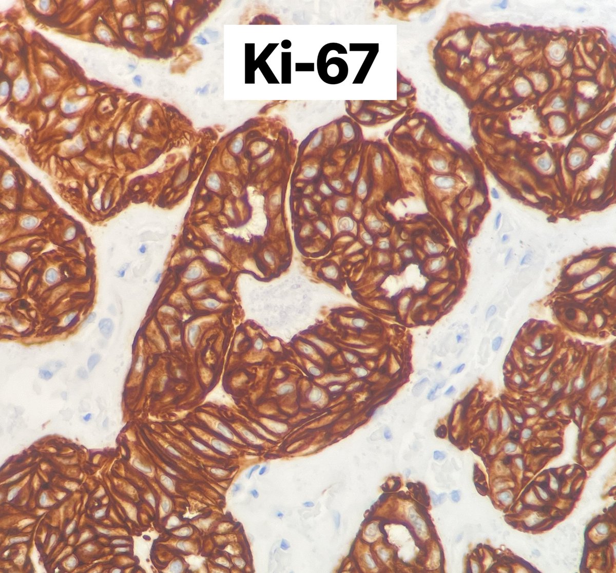 Toby Schmitt, MD tweet media