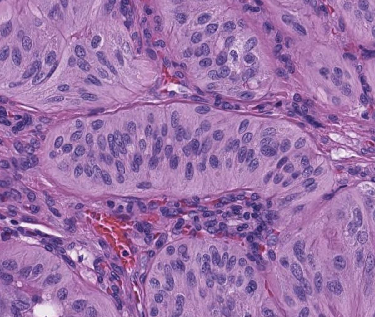 Toby Schmitt, MD tweet media