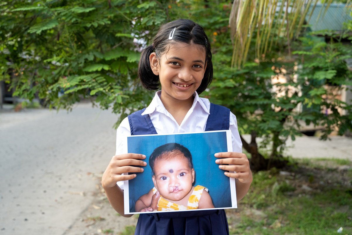 Smiletrain's tweet photo. Meet Asmi from India 🇮🇳 Born with a cleft, she faced challenges from day one. Thanks to free surgery through Smile Train, she can now eat, speak, and live confidently. Today, Asmi dreams of becoming a doctor proof of what’s possible with care and courage.
#smiletrain #cleft https://t.co/shJ5dSpd3N