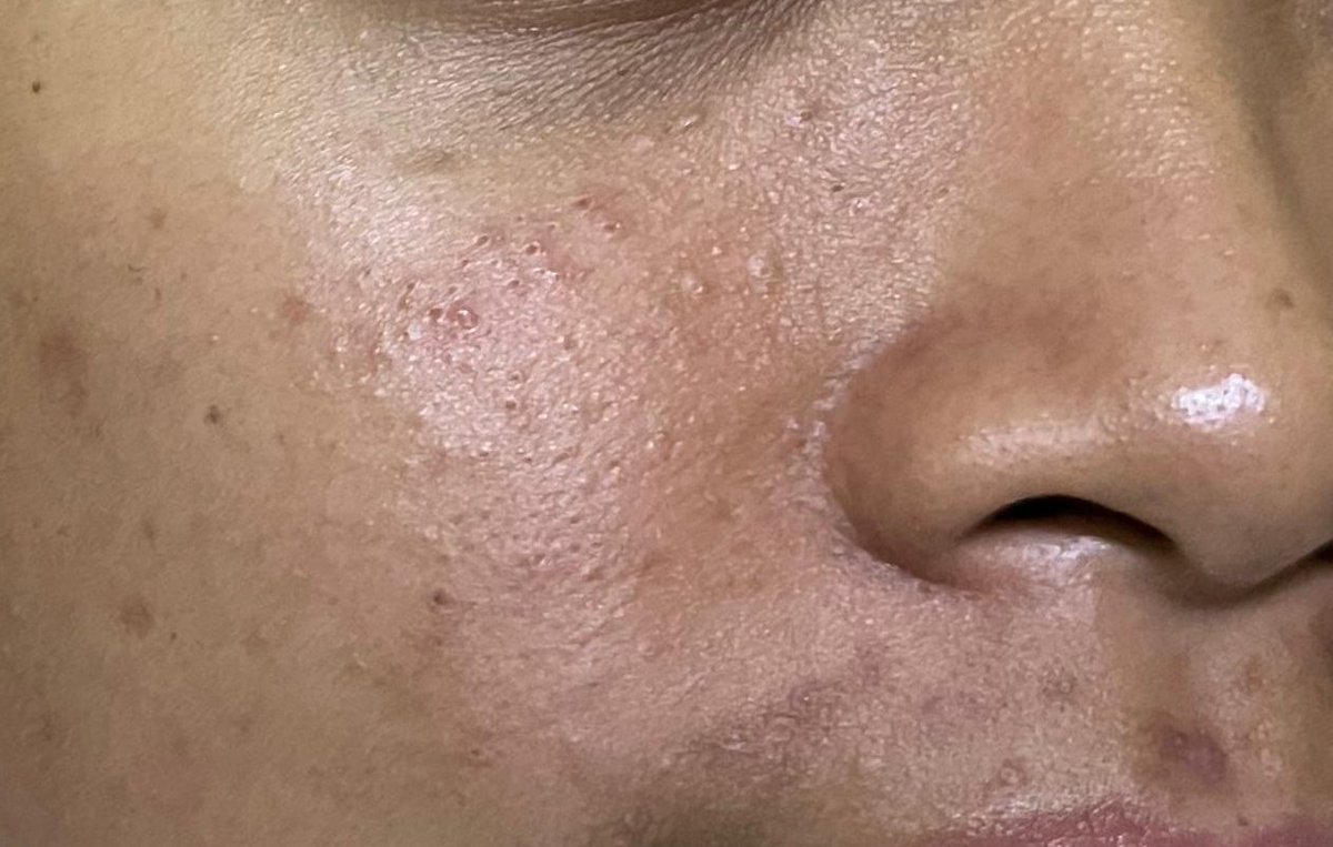 molkydd's tweet photo. gaiss minta saran cara ngilanginnya dong 🙏 udh hampir 2 bulan ga ilang ilang 😭 https://t.co/AB0jB5Vcjn