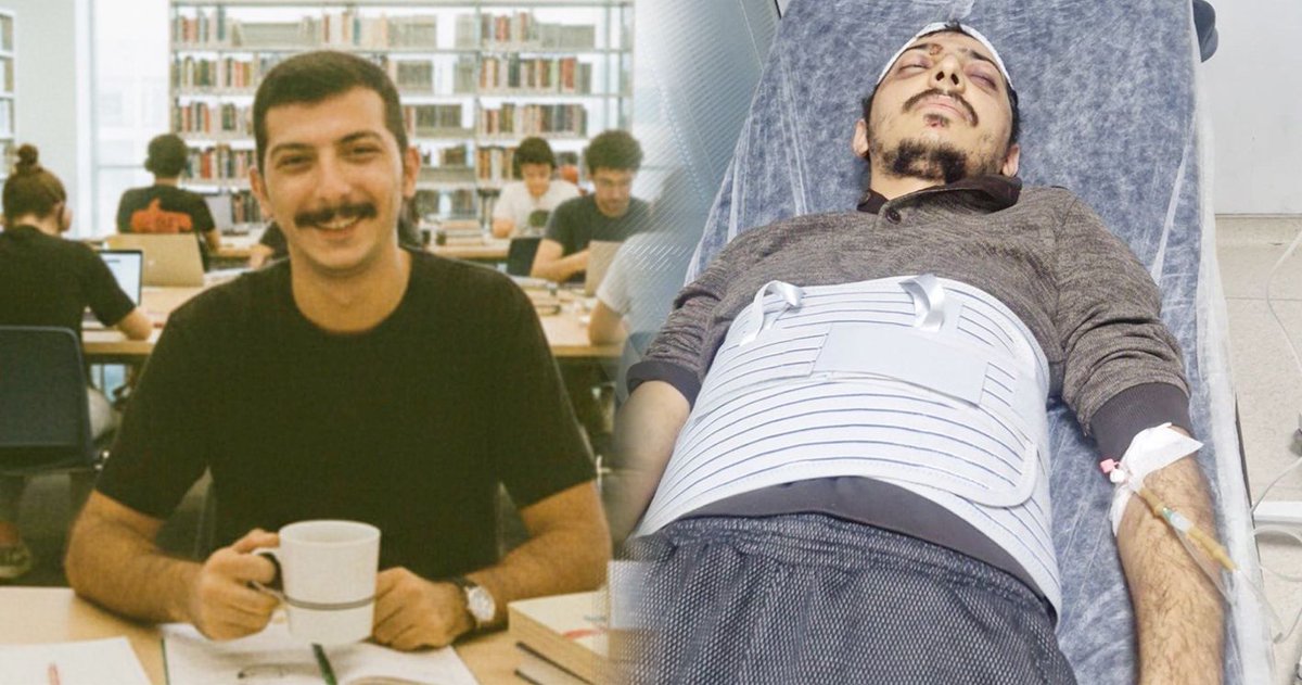 y_ozgurpolitika's tweet photo. 📌Bayrak yalanıyla ölmesi isteniyor

◾️Hiçbir ilgisi olmadığı halde 'bayrak indirdi' yalanıyla afişe edilen Kürt genci Diyar Koç, gördüğü işkencelerden dolayı yaşam mücadelesi veriyor.

📌550 kişi gözaltına alındı

📌Döverek gözaltına aldılar

https://t.co/ogytJnE05x https://t.co/TaHCwD8KhV