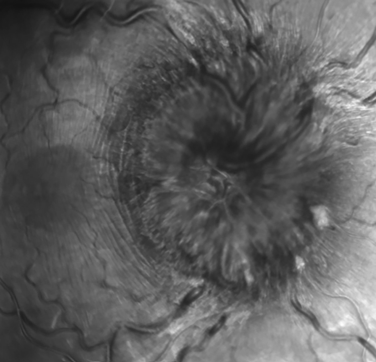 Ophthalmology tweet media