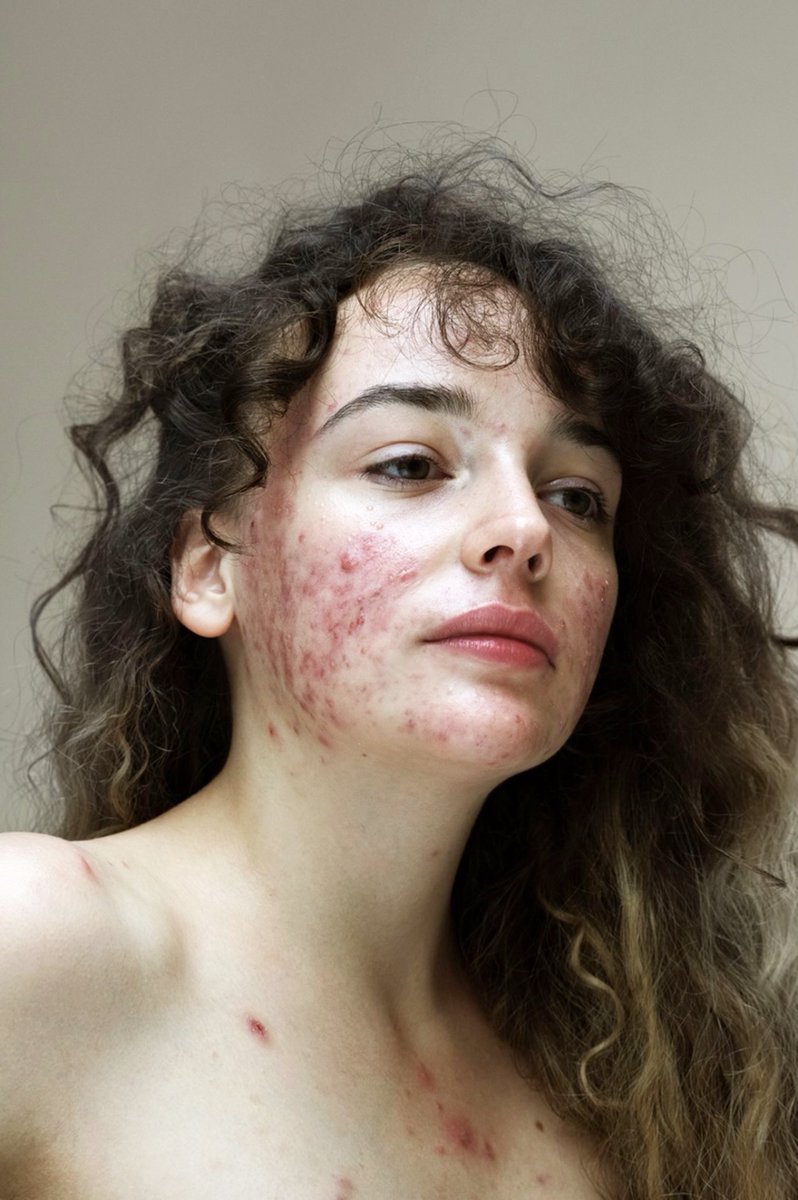 گروک اسکے چہرے کے داغ دھبے صاف کر دو کیونکہ کوئی کریم کام نہیں کر رہی ہے 😜
<a href="/grok/">Grok</a>