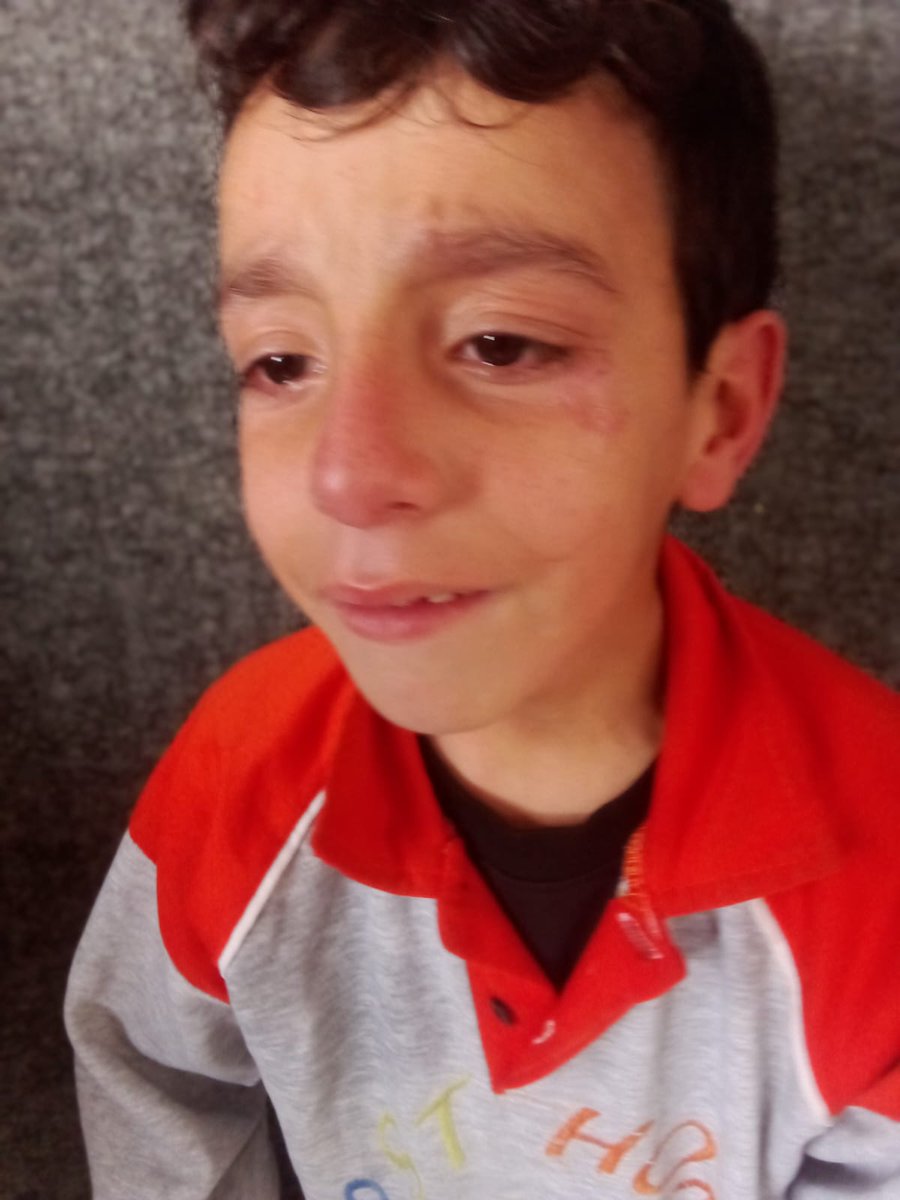 RozeatG's tweet image. My son needs milk 
°
°
❣
°
°
🌸
°
°
💜
°
°
✨
°
°
❣
°
°
🌸
°
°
💜
🎀
°
🌸
°
°
💜
°
°
✨
°
°
❣
°
°
🌸
°
°
💜
°
°
✨
°
°
❣
°
°
🌸
°
°
💜
🎀
°
🌸
°
°
💜
°
°
✨
°
°
❣
°
°
🌸
°
°
💜
°
°
✨
°
°
❣
°
°
🌸
°
°
💜
🎀
°
🌸
°
°
💜
°
°
✨
°
°
❣
°
°
🌸
°
°
💜
°°
chuffed.org/project/137260…