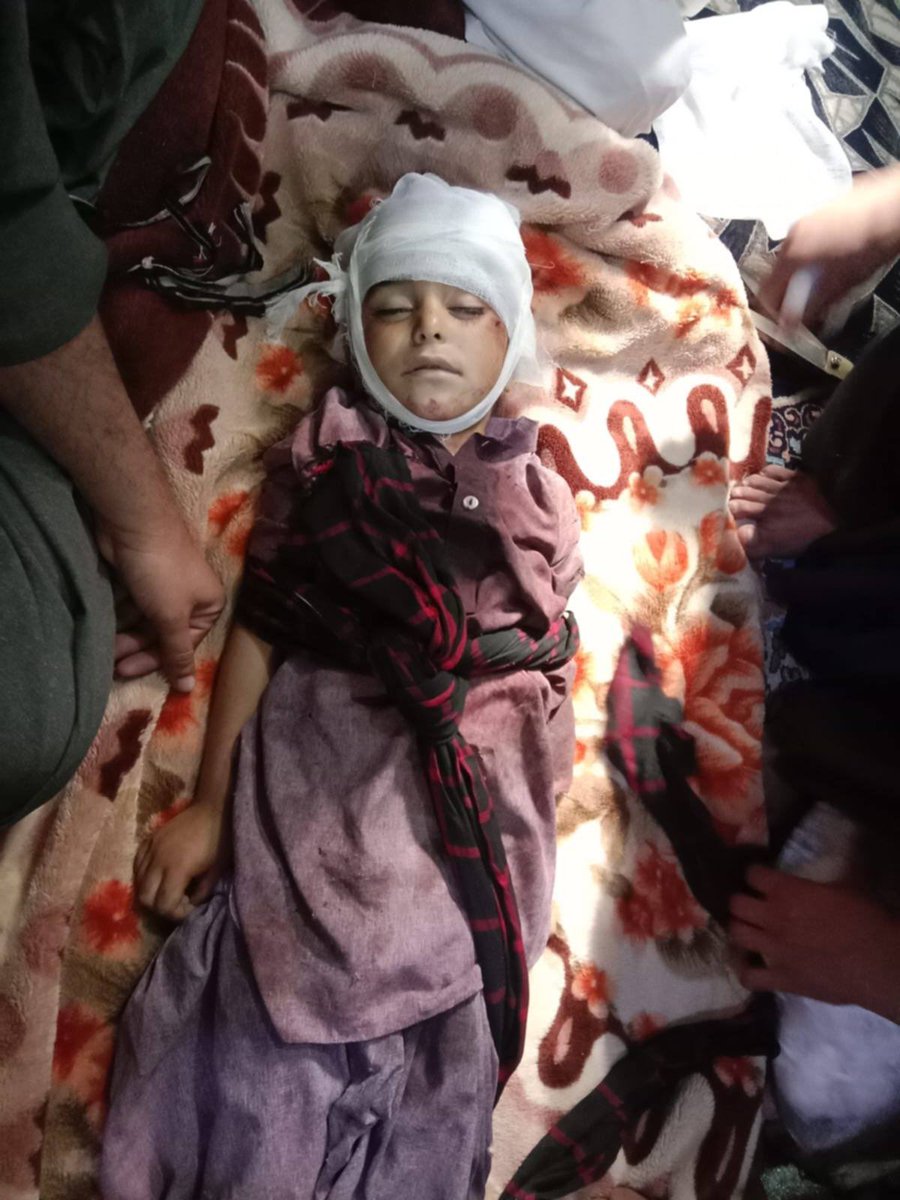 muneer5683's tweet photo. The Pakistani army is relentlessly bombing unarmed civilians in Nushki, Balochistan. Innocent women and children are being deliberately targeted, and numerous innocent people have lost their lives. This morning, a three-year-old child, Deedag Baloch, son of Abdul Manan, was killed in a Pakistani drone strike. This is blatant state brutality and a severe violation of human rights, happening right in front of the world.
The Pakistani army always claims it targets “terrorists,” yet ordinary Baloch civilians are being murdered. The question is: Was this three-year-old child a terrorist? What weapon was in his hands? What crime had he committed? The Pakistani army repeatedly targets ordinary Baloch people and labels them as terrorists. This violence must end immediately, and the ongoing state oppression against the Baloch people must be stopped.
#BalochistanUnderAttack #StopStateViolence #HumanRights #PakistanMilitary #JusticeForBaloch