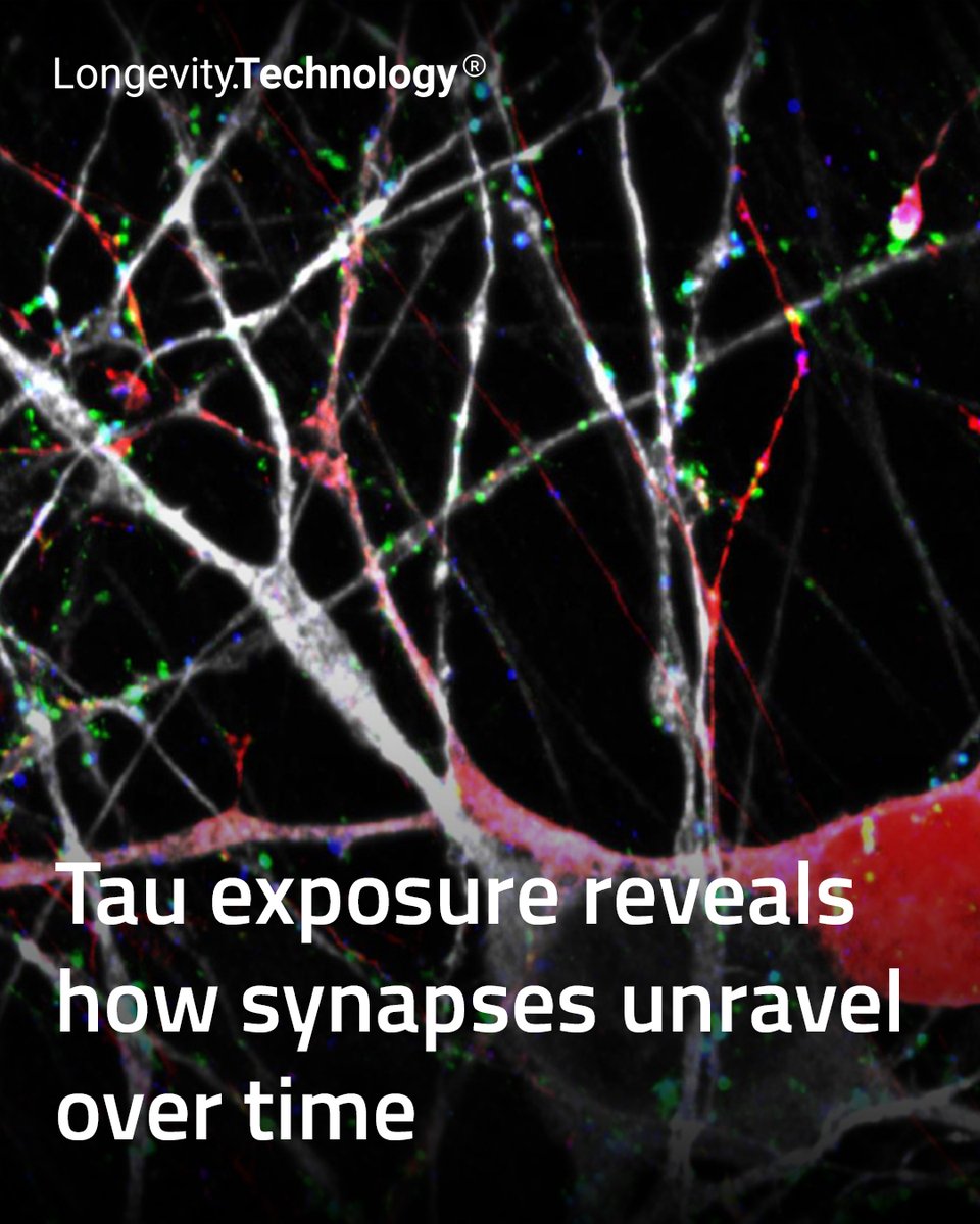 LongevityTech's tweet photo. New research maps the slow cascade from brief tau toxicity to lasting synaptic dysfunction, offering a more dynamic view of neurodegeneration.

https://t.co/GuLGMbd2BB

#longevity #neuroscience #alzheimersresearch #braindegeneration #synapses #agingbrain https://t.co/8tuLBJC5wt