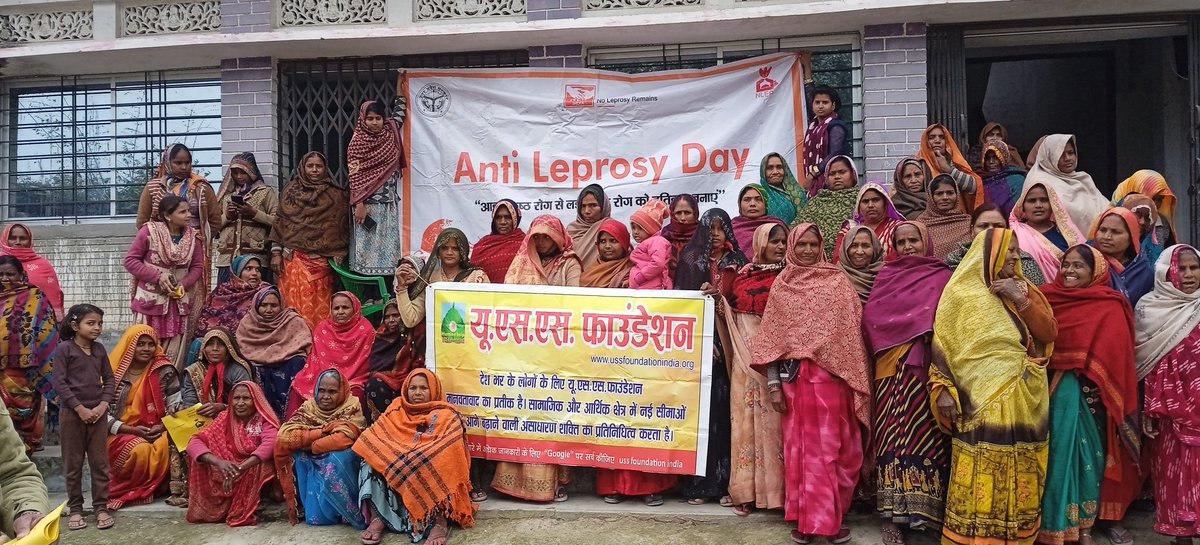 uss_foundation's tweet photo. कुष्ठ जन जागरूकता कार्यक्रम का आयोजन। 
संस्था यू.एस.एस.फाउंडेशन एवं एनएलआर इंडिया के सम्मिलित सहयोग से नकाईन गांव, वाराणसी में विश्व कुष्ठ दिवस के उपलक्ष में जन जागरूकता कार्यक्रम का आयोजन किया गया। जिसमें कुष्ठ रोग के लक्षण, उपाय, कारक के विषय में विस्तृत रूप से चर्चा किया गया। https://t.co/NroKVyaAzw
