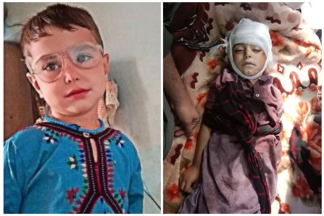 BalochV4Justice's tweet photo. Baloch Voice for Justice strongly condemns the killing of unarmed Baloch civilians in a military drone strike on civilian homes in Killi Jamaldini, Nushki District, on 1 February 2026. The attack struck residential areas with no active hostilities.

A minor child, Deedag s o Abdul Manan, was among those killed. The victims included women and elderly persons. All were civilians inside their homes at the time of the strike.

The killing of unarmed civilians, including a child, constitutes a serious violation of international humanitarian law. Such acts are prohibited under the Geneva Conventions and amount to a war crime.

Baloch Voice for Justice calls for independent and transparent investigations and for accountability under international law. Silence and statements alone are insufficient. 

#StopBalochGenocide 

@UNHumanRights @amnesty @hrw @ICRC @UNICEF @EU_HumanRights